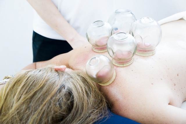cupping-therapy-gf3773a11e_640